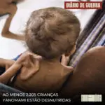As imagens das crianças Yanomami apontam para a existência de quadros de desnutr…